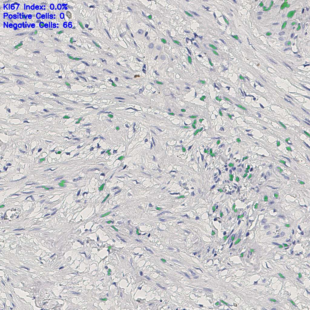 slice_11_21_x9856_y18816.png