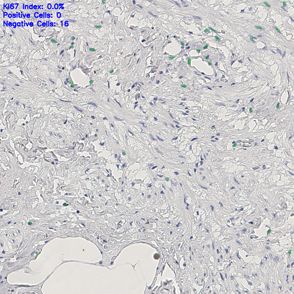 slice_11_22_x9856_y19712.png