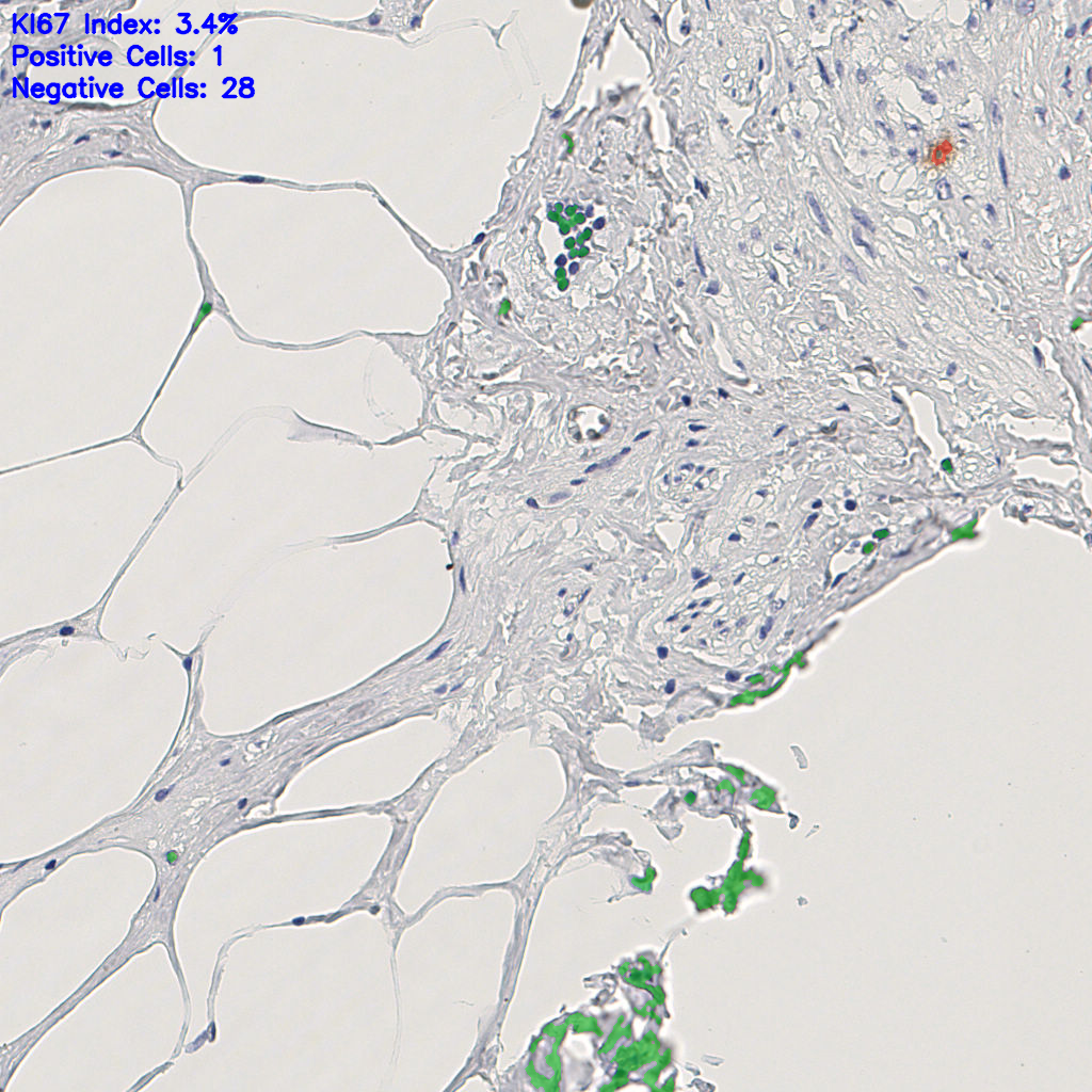 slice_11_23_x9856_y20608.png