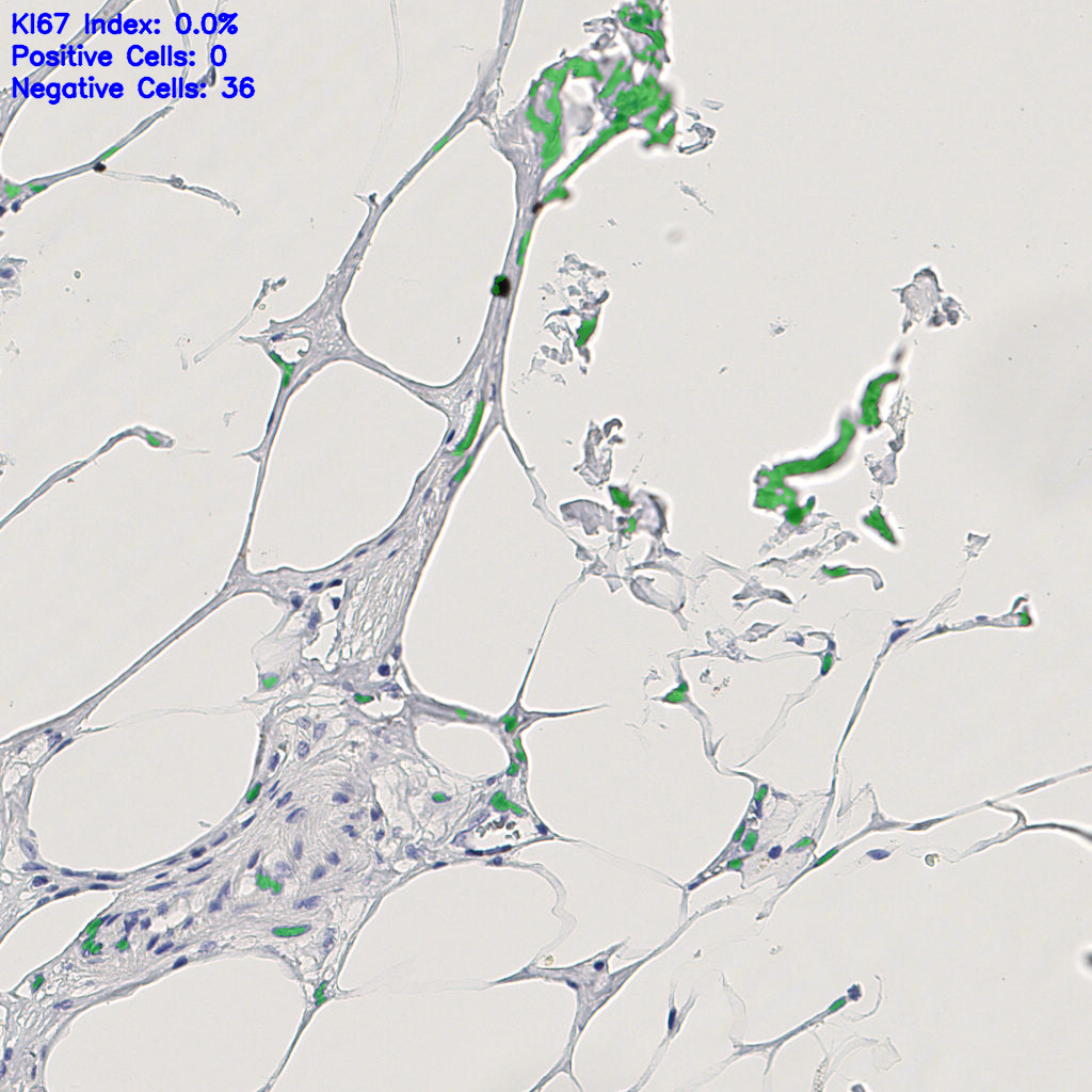 slice_11_24_x9856_y21504.png