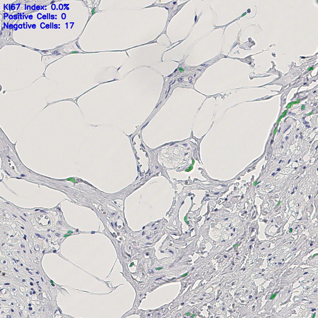 slice_11_25_x9856_y22400.png