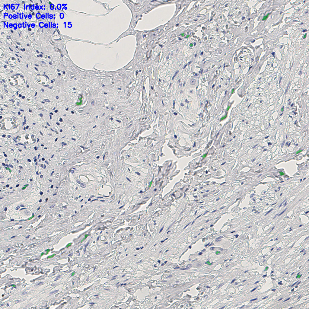 slice_11_26_x9856_y23296.png