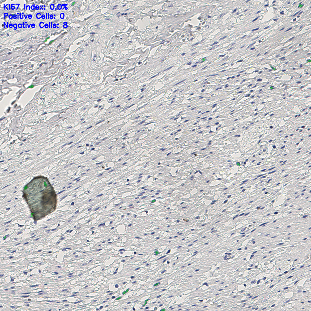 slice_11_27_x9856_y24192.png