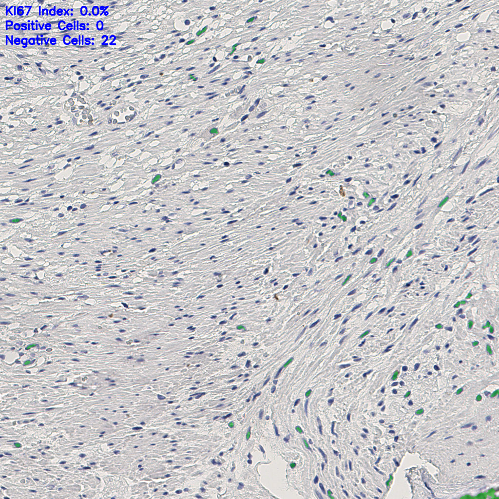slice_11_28_x9856_y25088.png