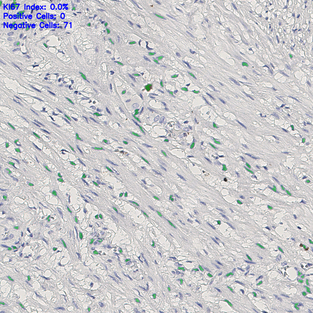 slice_12_21_x10752_y18816.png