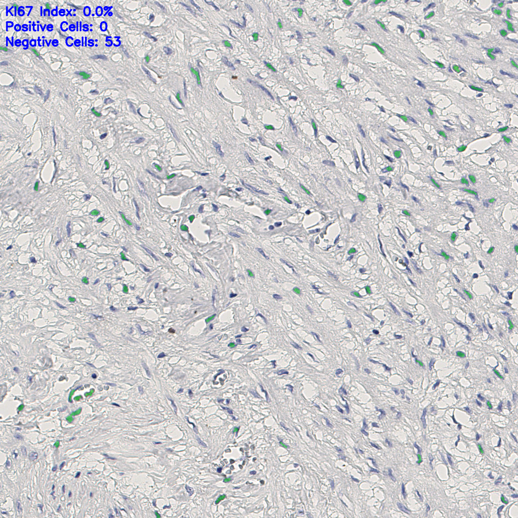 slice_12_22_x10752_y19712.png