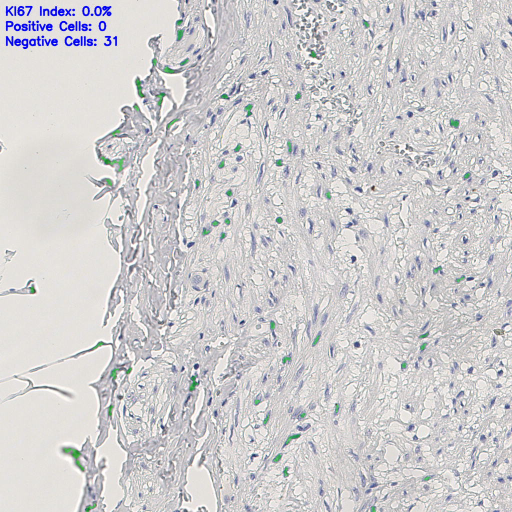 slice_12_24_x10752_y21504.png