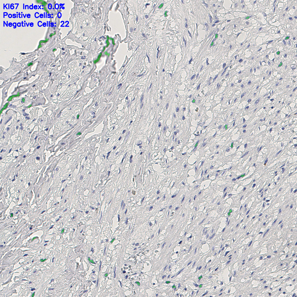 slice_12_25_x10752_y22400.png