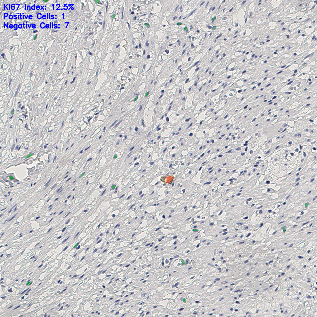 slice_12_26_x10752_y23296.png