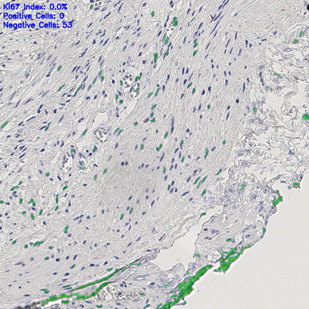 slice_12_28_x10752_y25088.png