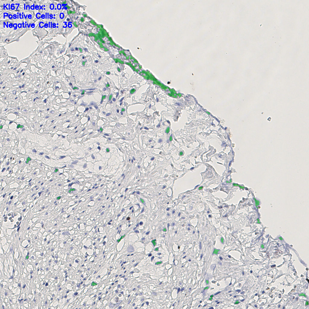 slice_13_20_x11648_y17920.png