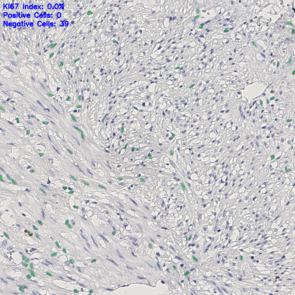 slice_13_21_x11648_y18816.png