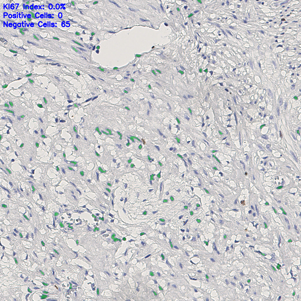 slice_13_22_x11648_y19712.png