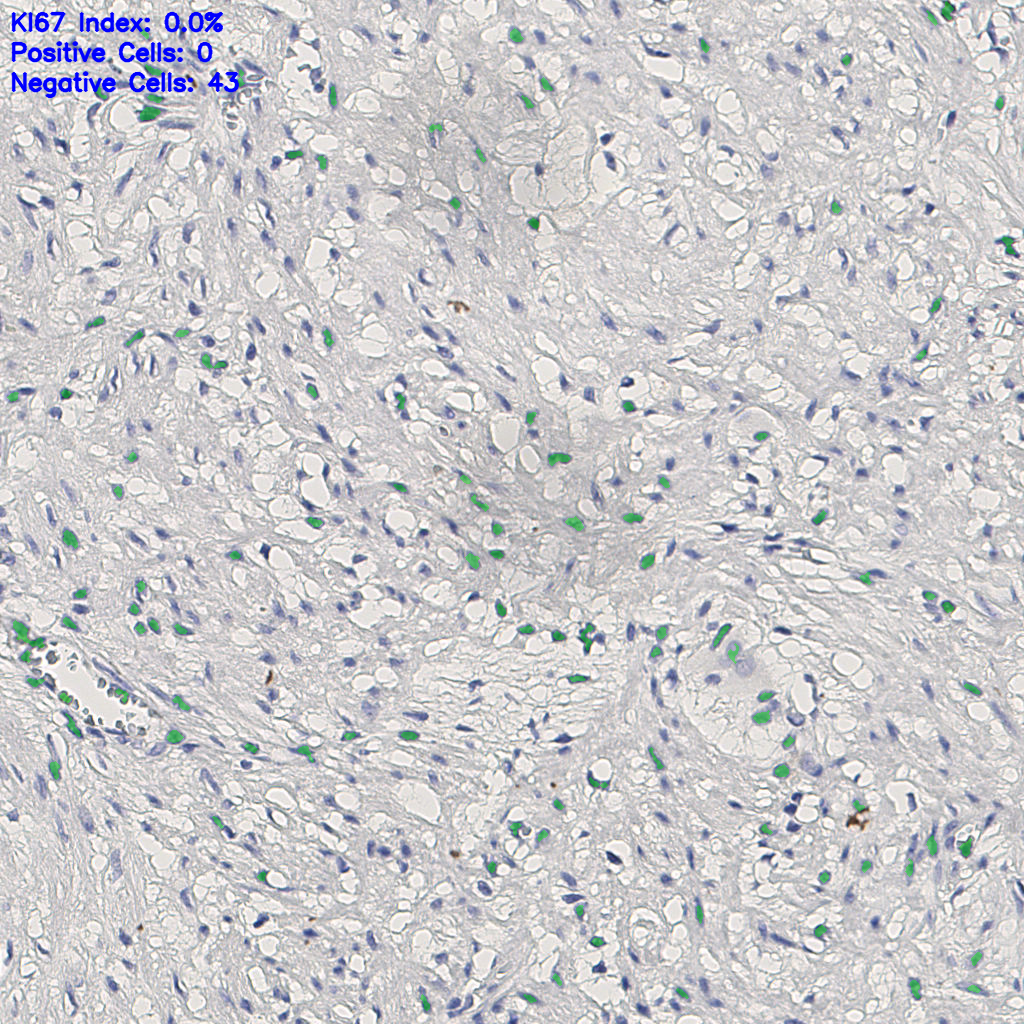 slice_13_23_x11648_y20608.png