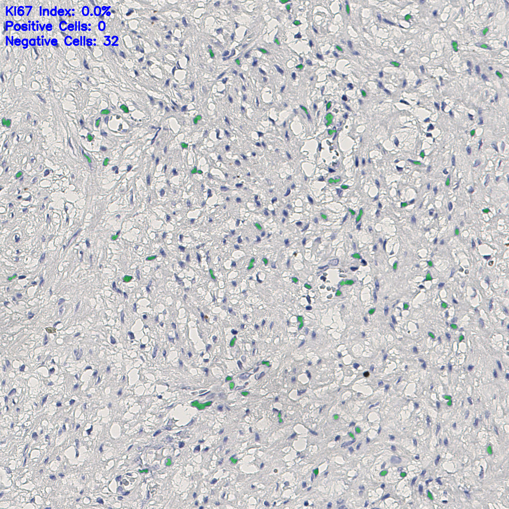 slice_13_24_x11648_y21504.png