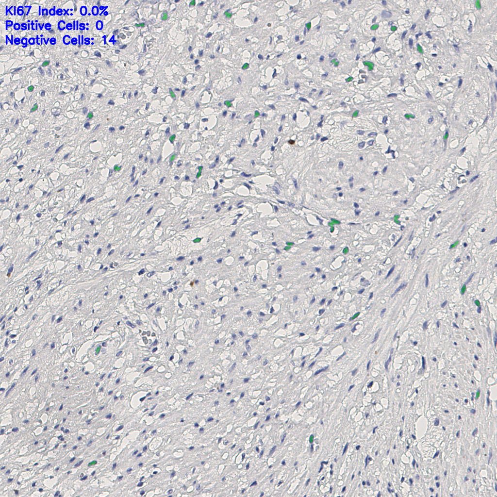 slice_13_25_x11648_y22400.png