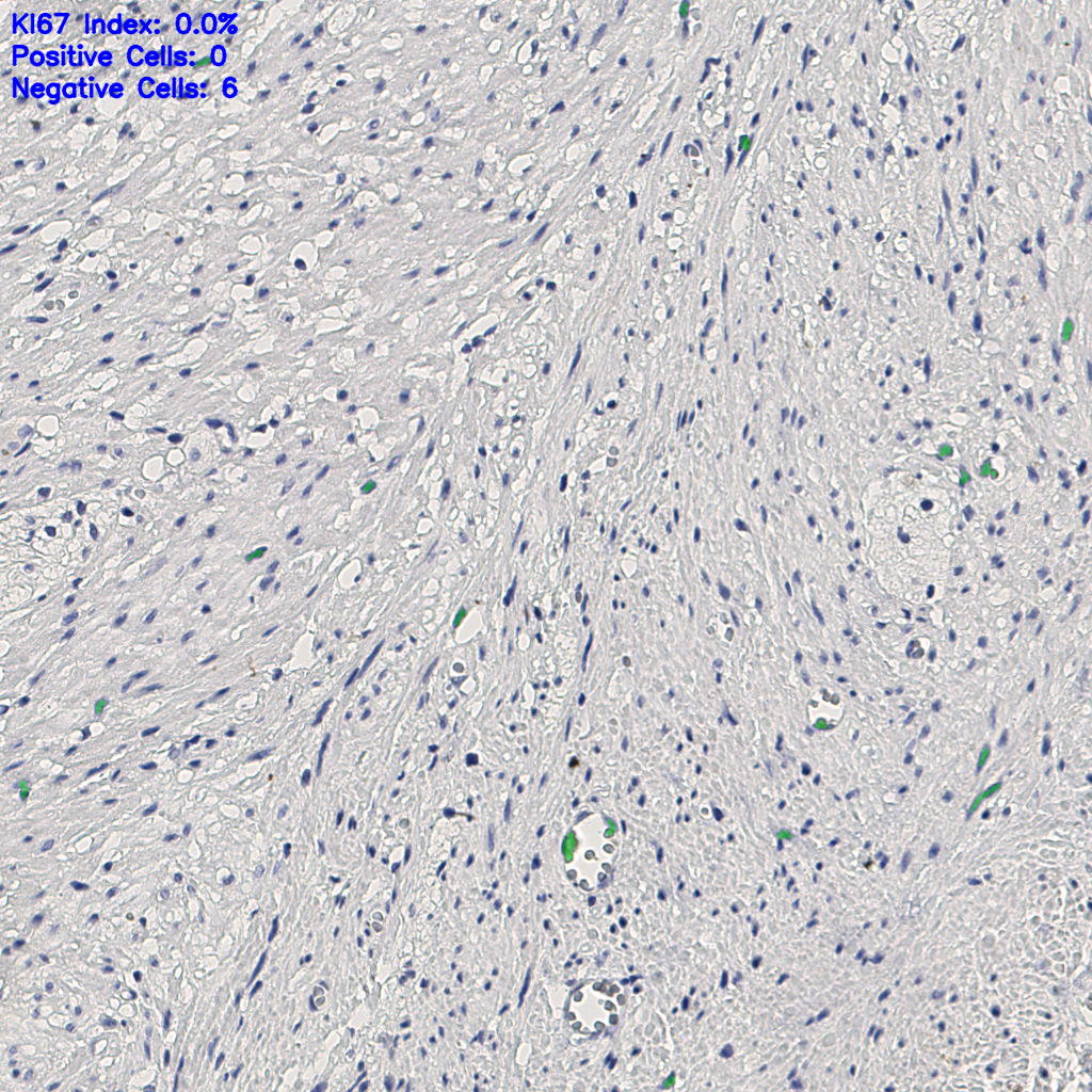 slice_13_26_x11648_y23296.png