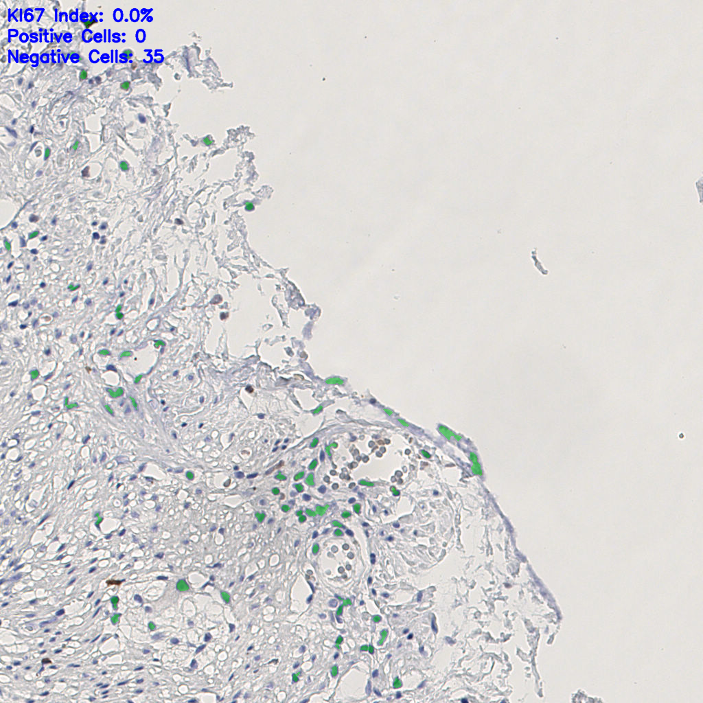 slice_14_21_x12544_y18816.png