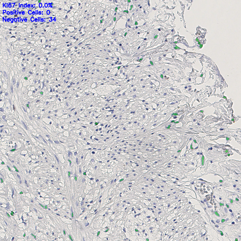 slice_14_22_x12544_y19712.png