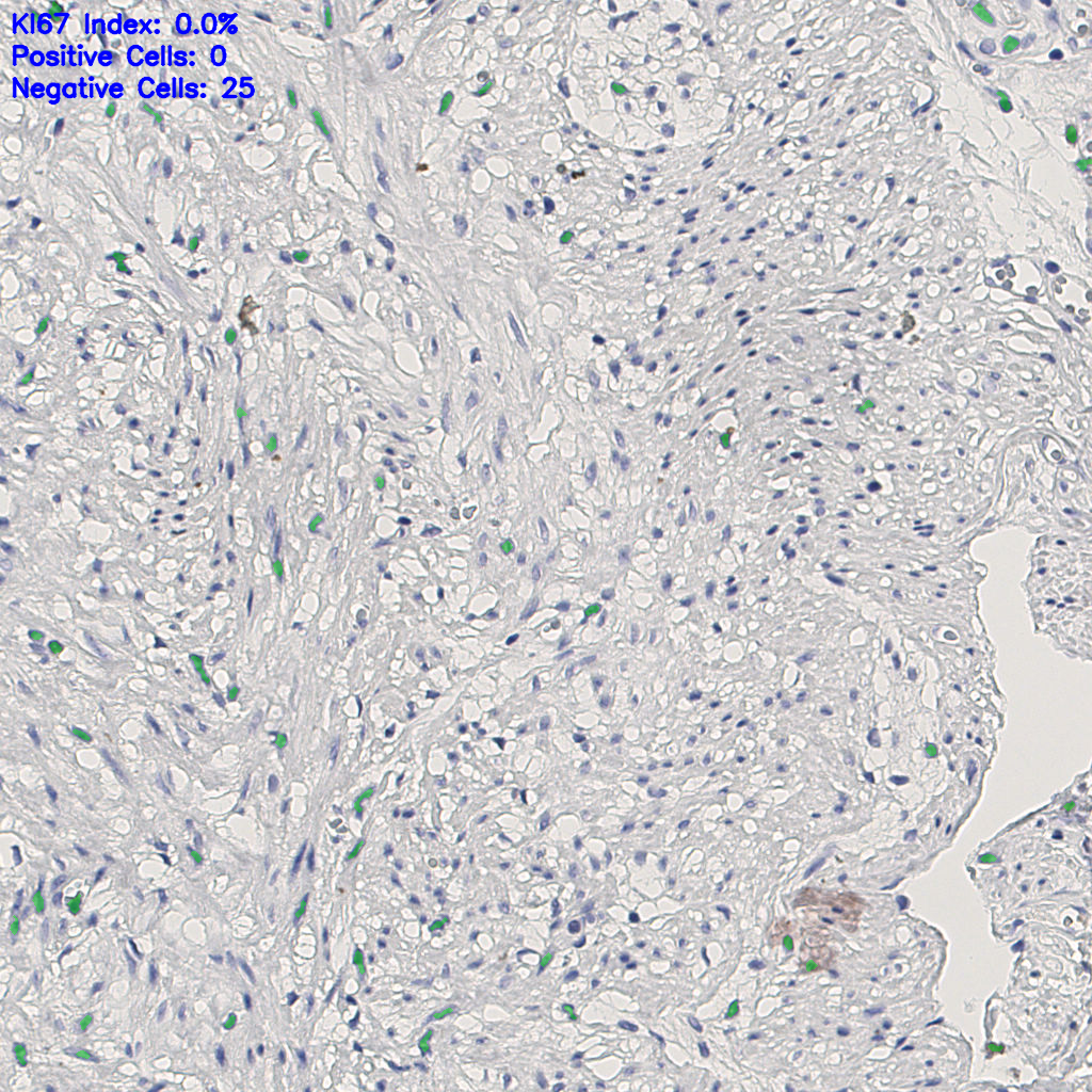 slice_14_23_x12544_y20608.png