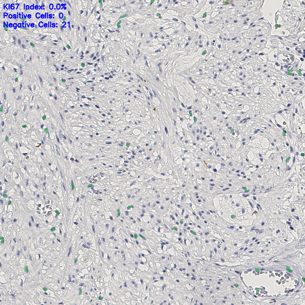 slice_14_24_x12544_y21504.png