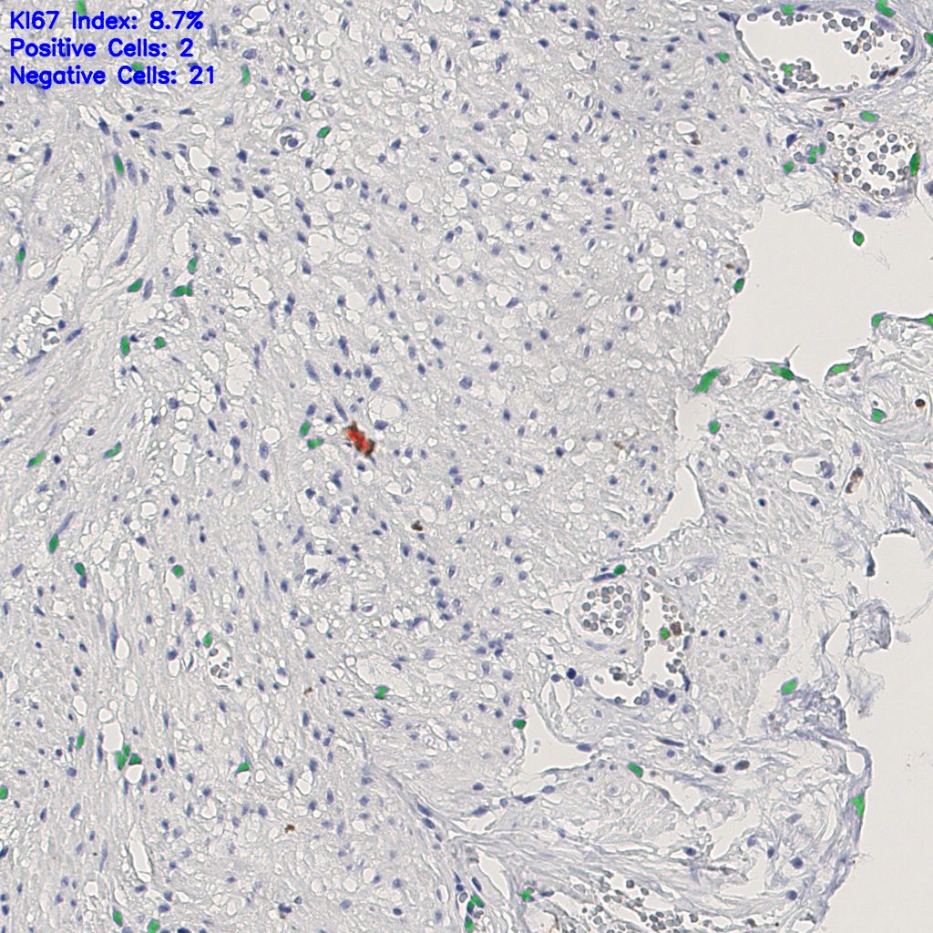 slice_14_25_x12544_y22400.png