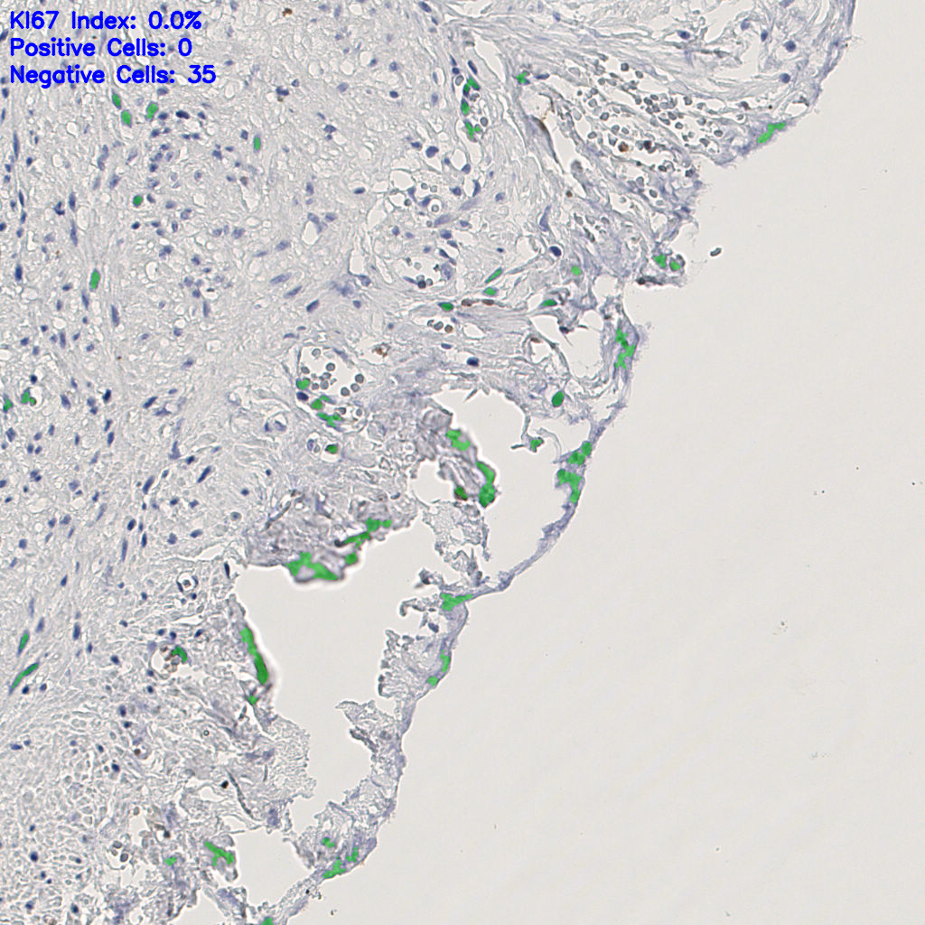 slice_14_26_x12544_y23296.png