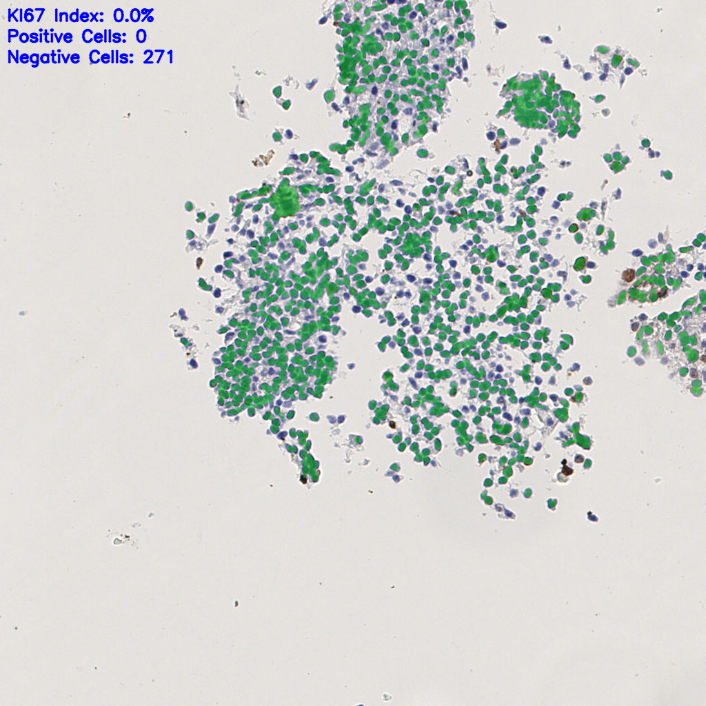slice_2_12_x1792_y10752.png