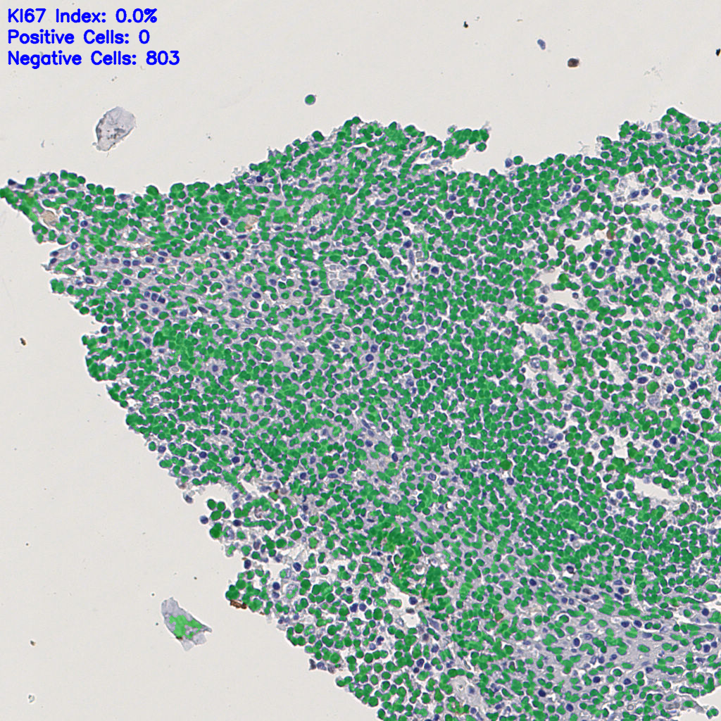 slice_2_14_x1792_y12544.png