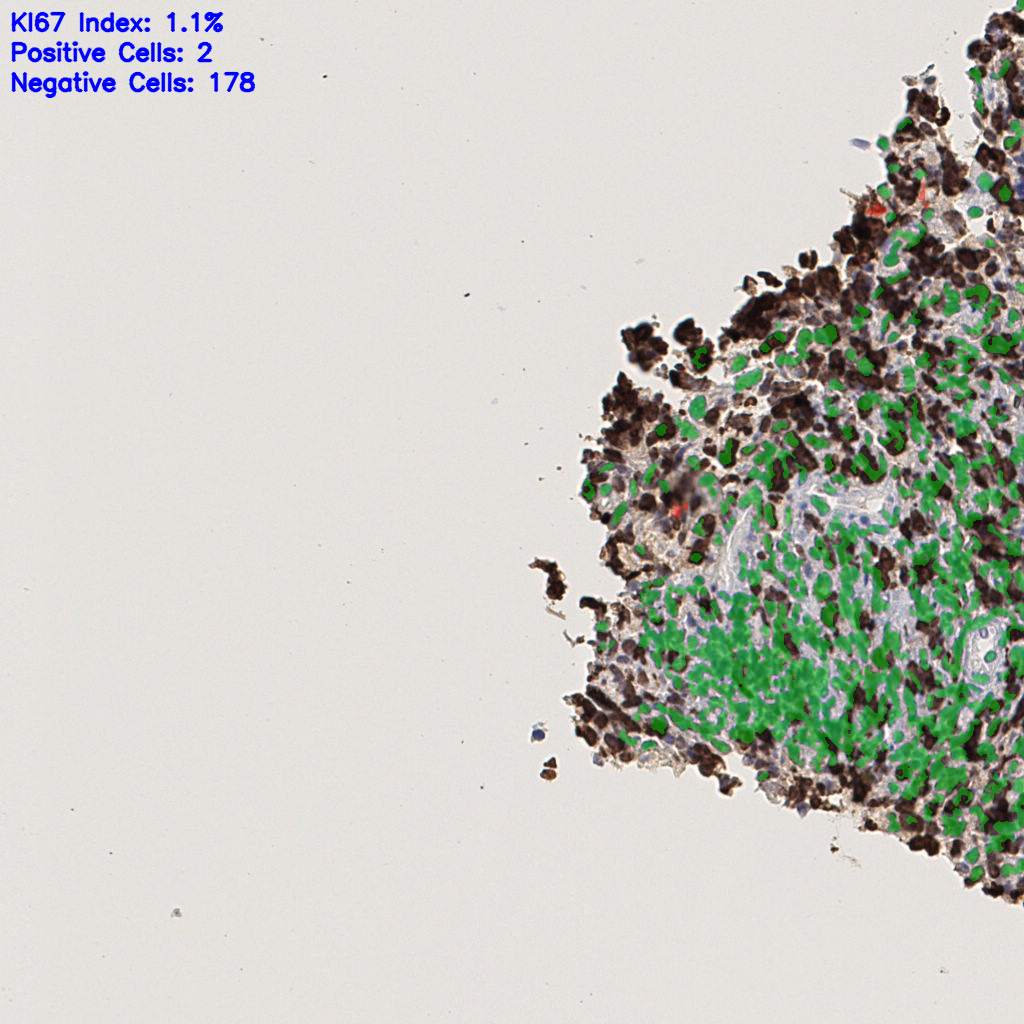 slice_38_11_x34048_y9856.png