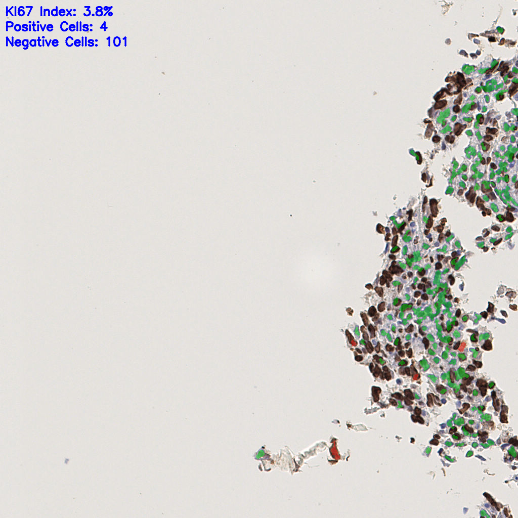 slice_38_4_x34048_y3584.png