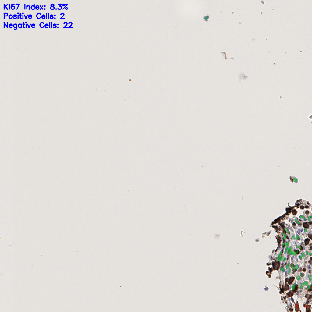slice_38_6_x34048_y5376.png