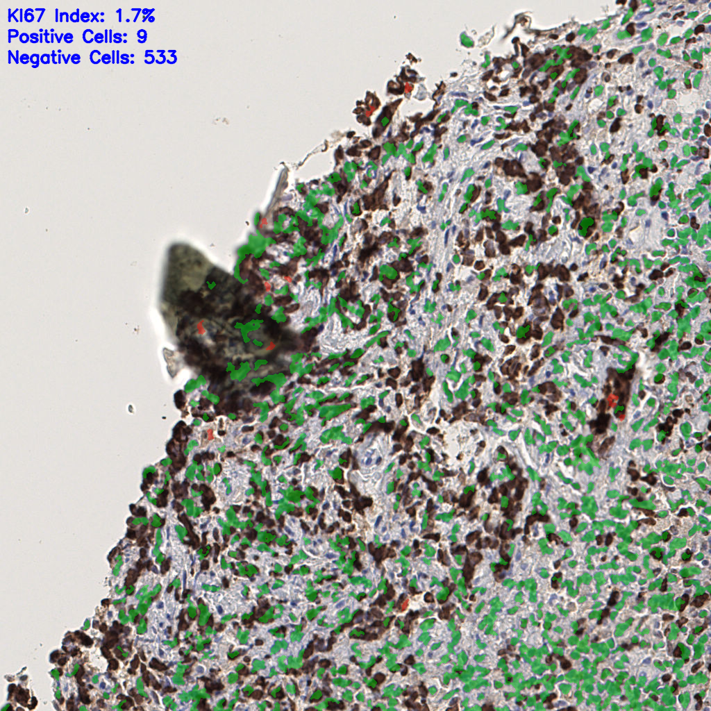 slice_39_10_x34944_y8960.png