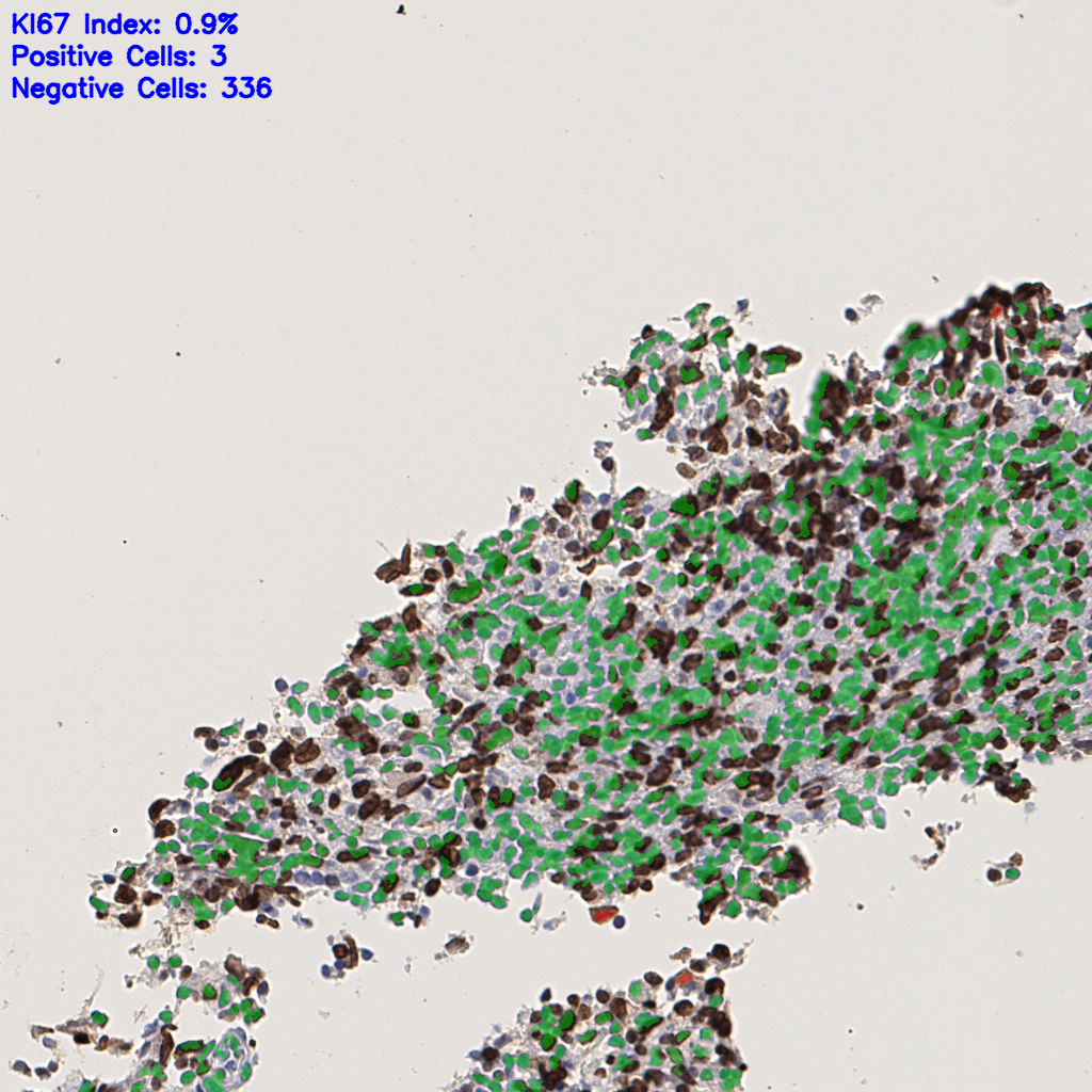 slice_39_3_x34944_y2688.png