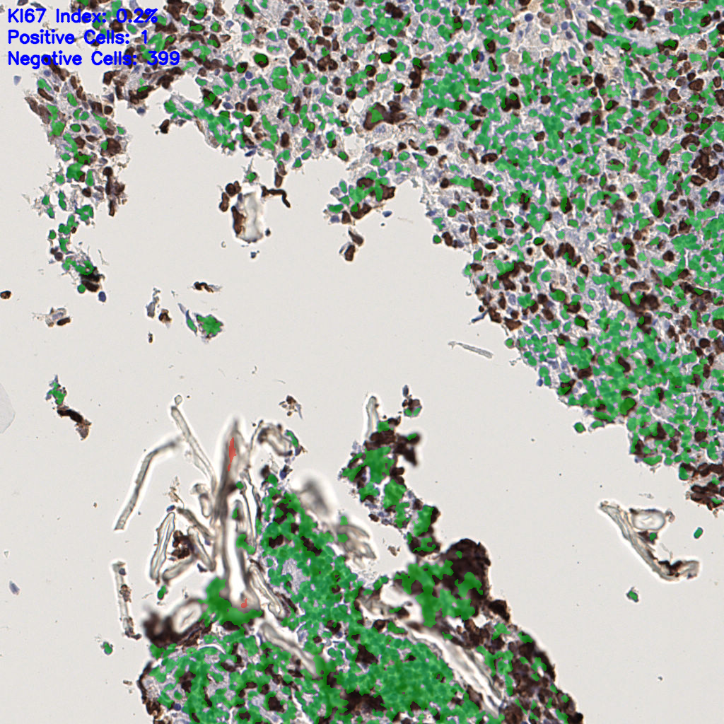 slice_39_5_x34944_y4480.png