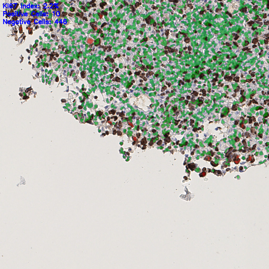 slice_39_7_x34944_y6272.png