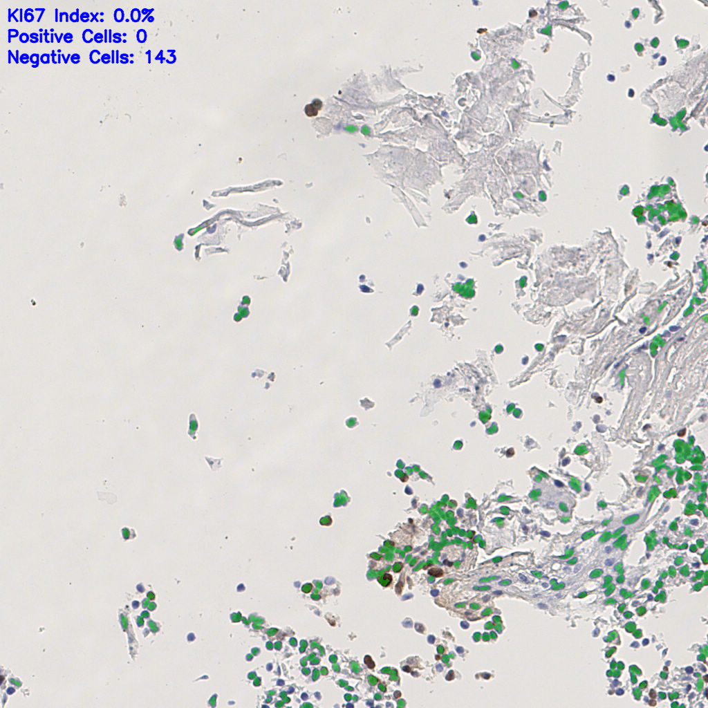 slice_3_11_x2688_y9856.png