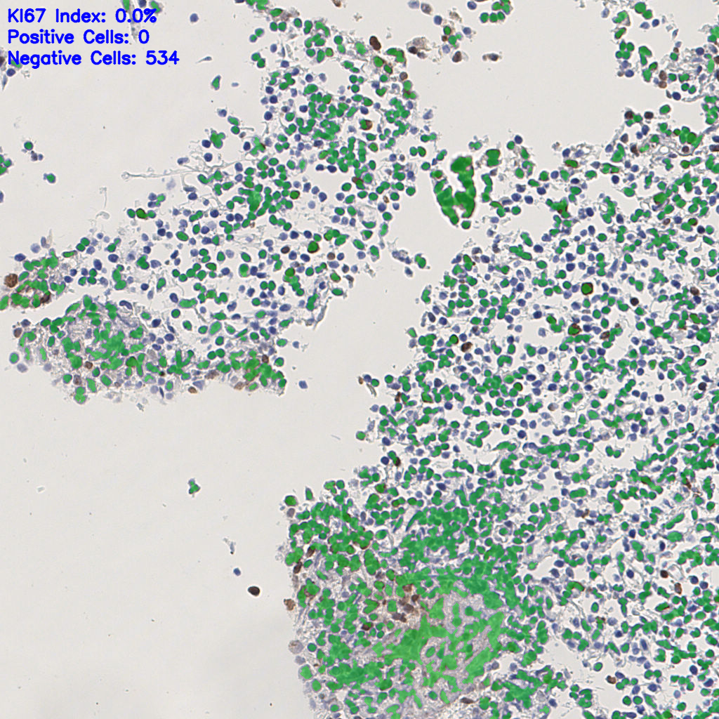 slice_3_12_x2688_y10752.png