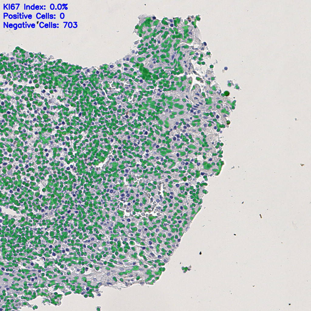 slice_3_14_x2688_y12544.png