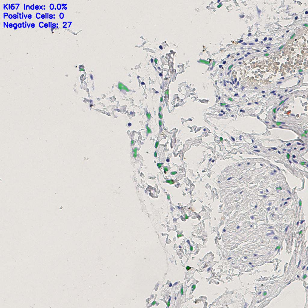 slice_3_21_x2688_y18816.png