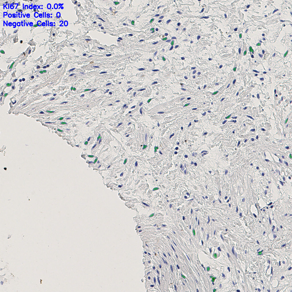 slice_3_24_x2688_y21504.png