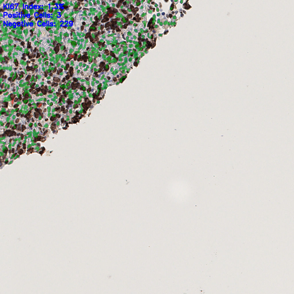 slice_40_11_x35840_y9856.png