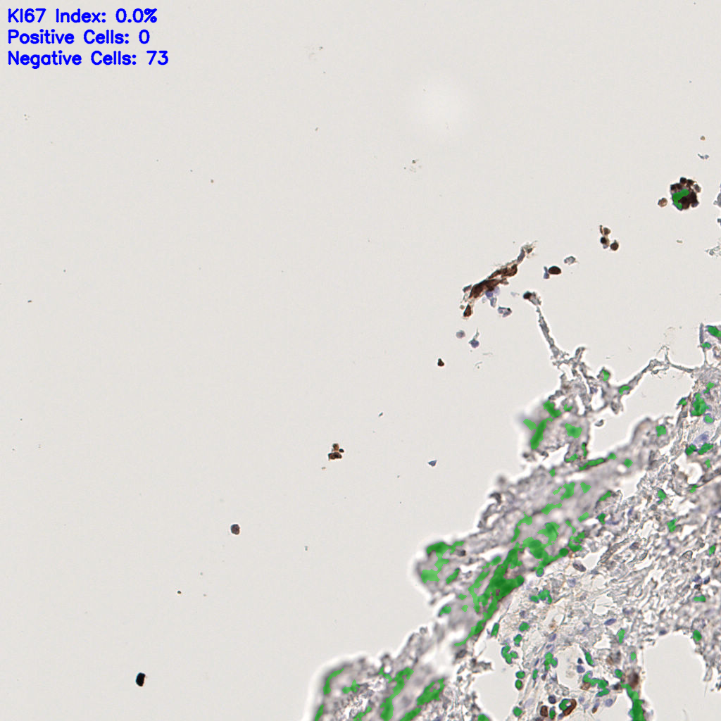 slice_40_13_x35840_y11648.png