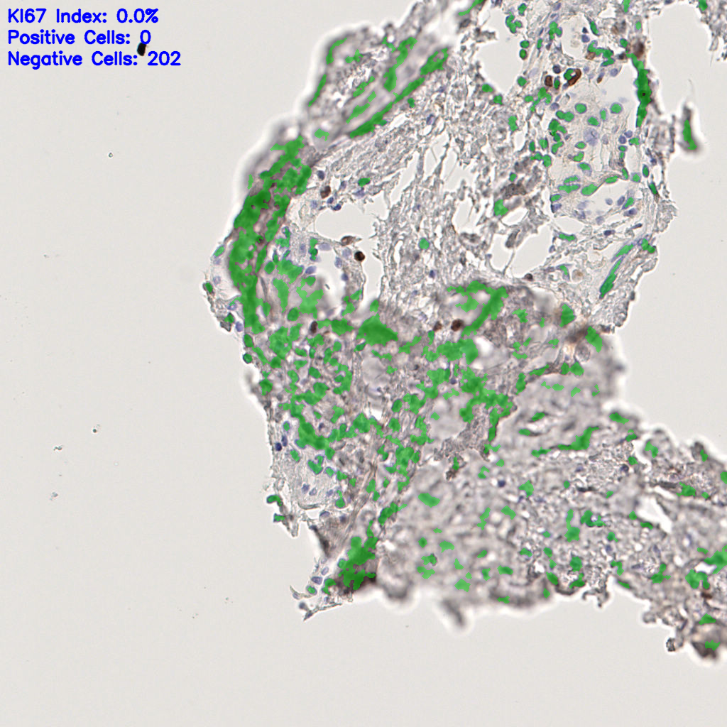 slice_40_14_x35840_y12544.png