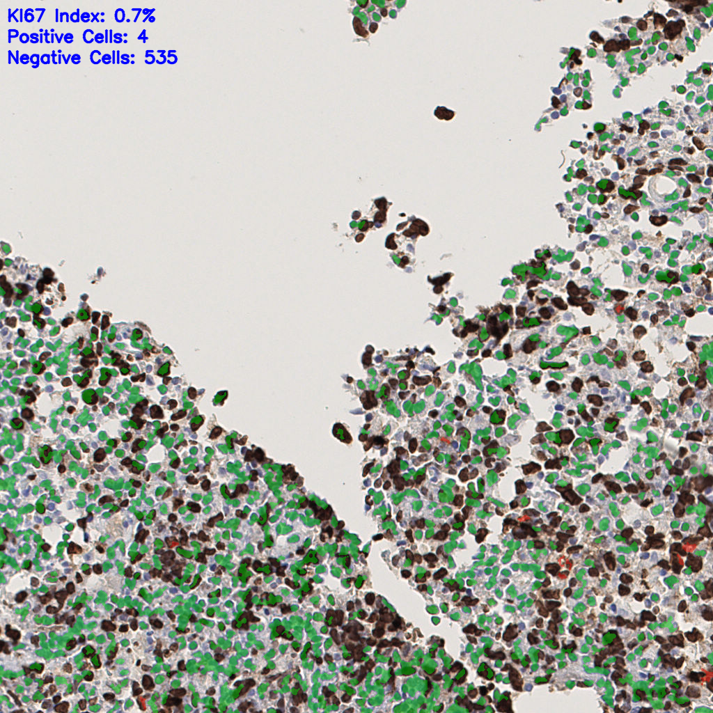 slice_40_4_x35840_y3584.png