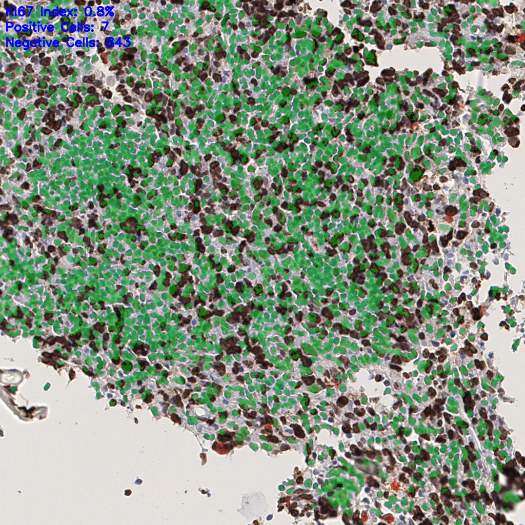 slice_40_5_x35840_y4480.png