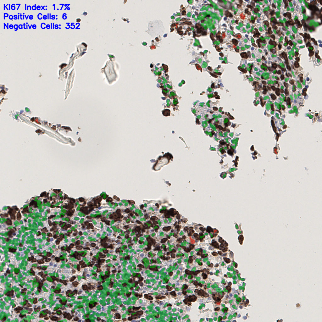 slice_40_6_x35840_y5376.png