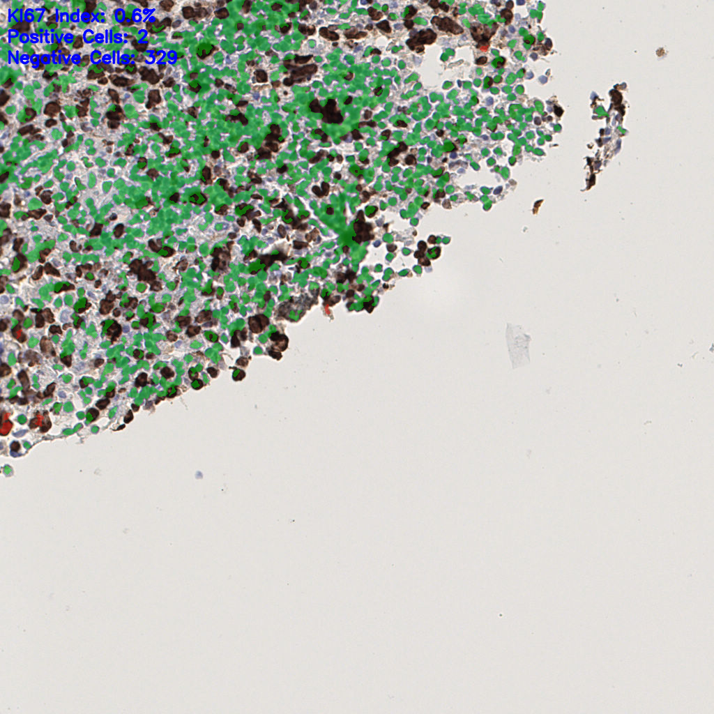 slice_40_7_x35840_y6272.png