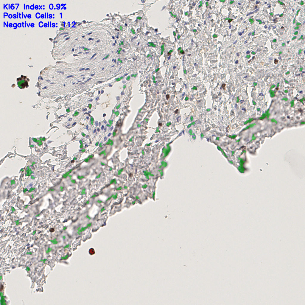 slice_41_13_x36736_y11648.png