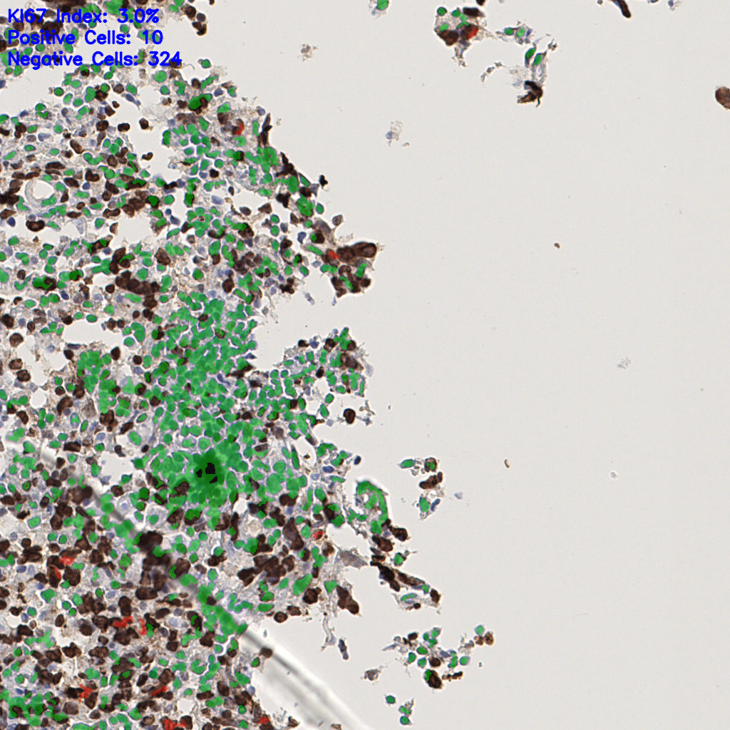slice_41_4_x36736_y3584.png